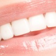 O clareamento dos dentes é uma das técnicas mais procuradas e muitas vezes é o...